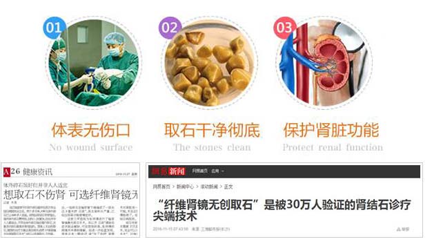 肾结石手术要多少钱？(已解决6955条)(图3)