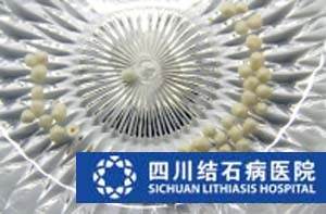 热议｜四川结石病医院公益结石展  广大市民热情点赞(图2)