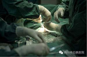 胆结石的治疗价格是怎么样的？(图3)