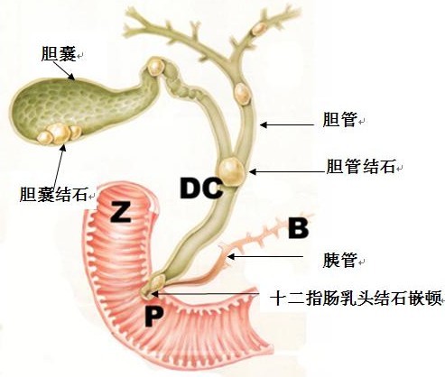 了解症状，确诊病情，小心病变！(图1)