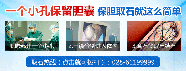 怀疑自己有胆结石？来做一个胆结石自测表吧(图2)