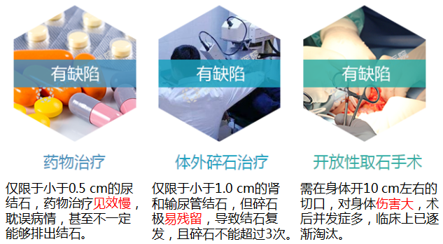 快速排出尿结石,这个方法你不能不知道(图1) 快速排出尿结石,这个方法你不能不知道(图1)